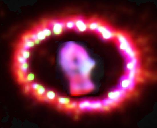 Disco de detritos envolvendo a Supernova 1987A.